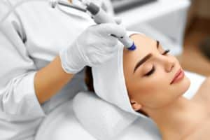 What Are The Benefits of Microdermabrasion