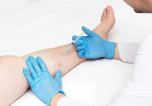 Sclerotherapy-Bloom Medspa MN