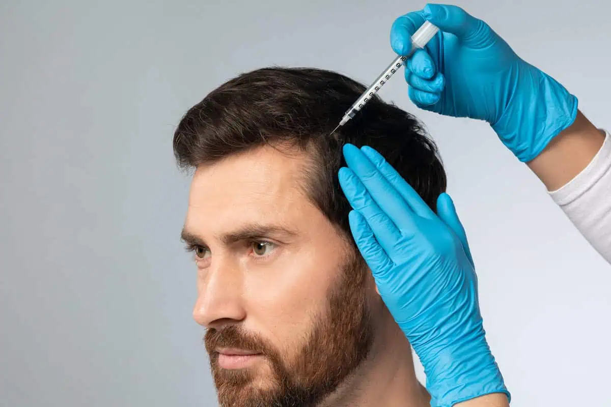 Hair Restoration with Natural Growth Factors in Glenwood, MN by Bloom MedSpa