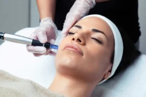 Microneedling by SMB Healthcare LLC DBA Bloom MedSpa in Glenwood, MN