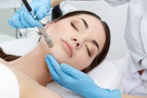 Microdermabrasion Background History of the Procedure