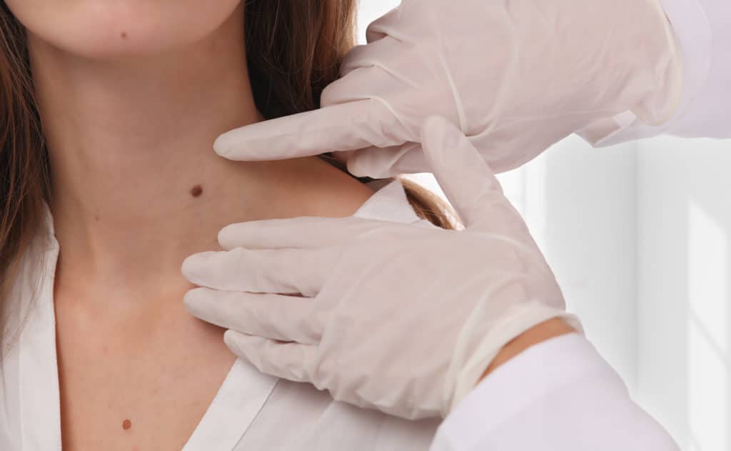 What Are Skin Tags, And How Do Doctors Treat These Tags